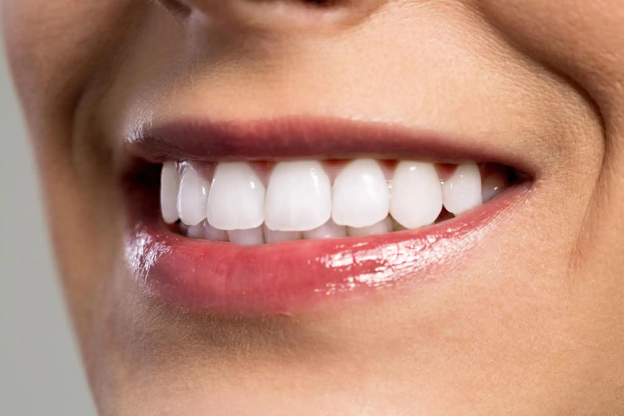 after seeing the Cosmetic Dentist in Grosse Pointe Woods