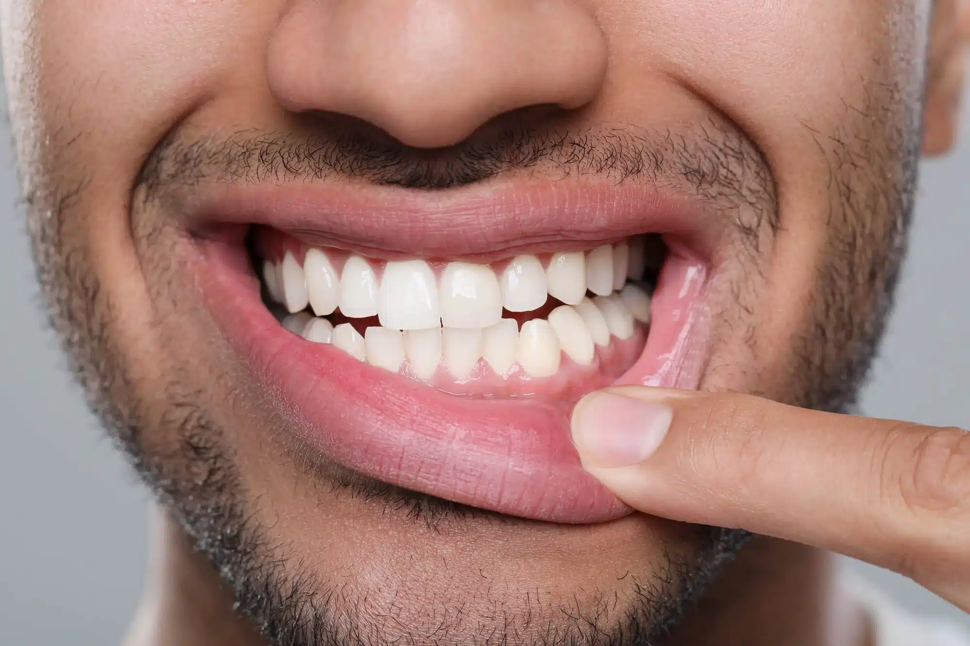 healthy gums after seeing a General Dentist in Grosse Pointe Woods