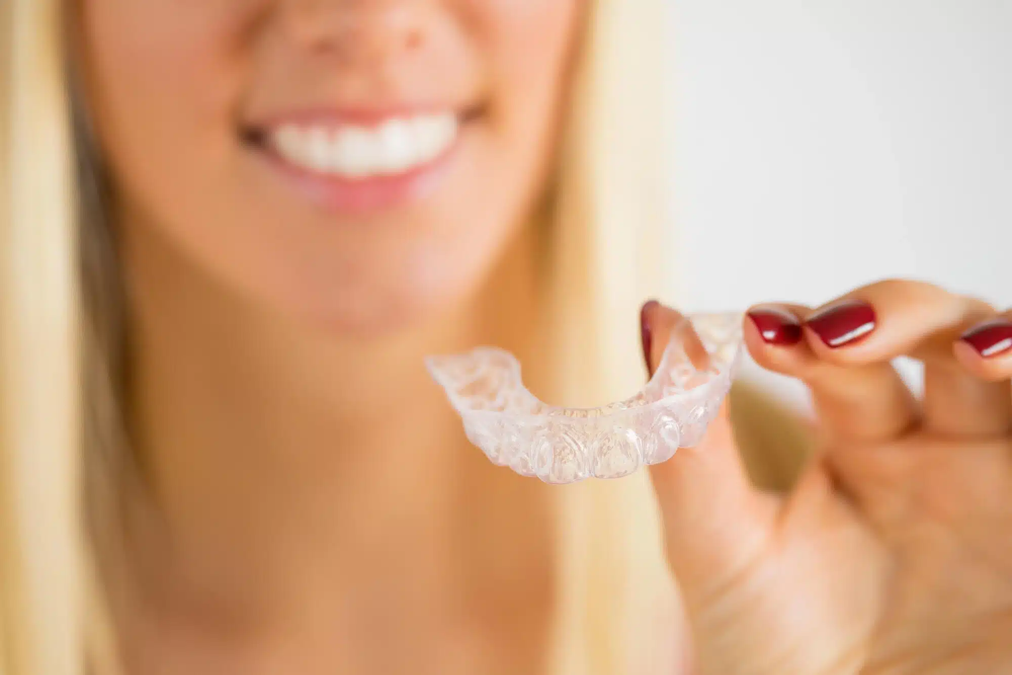 mouth-guard-from-an-Orthodontist-in-Grosse-Pointe-MI