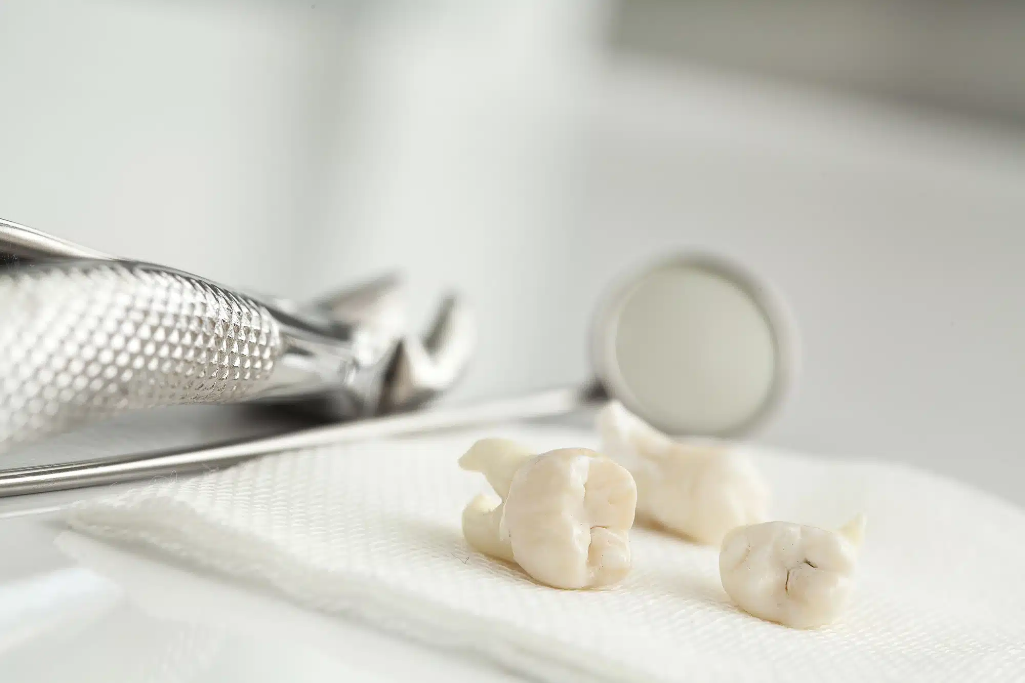 teeth after extraction with a general dentist in Grosse Pointe Woods