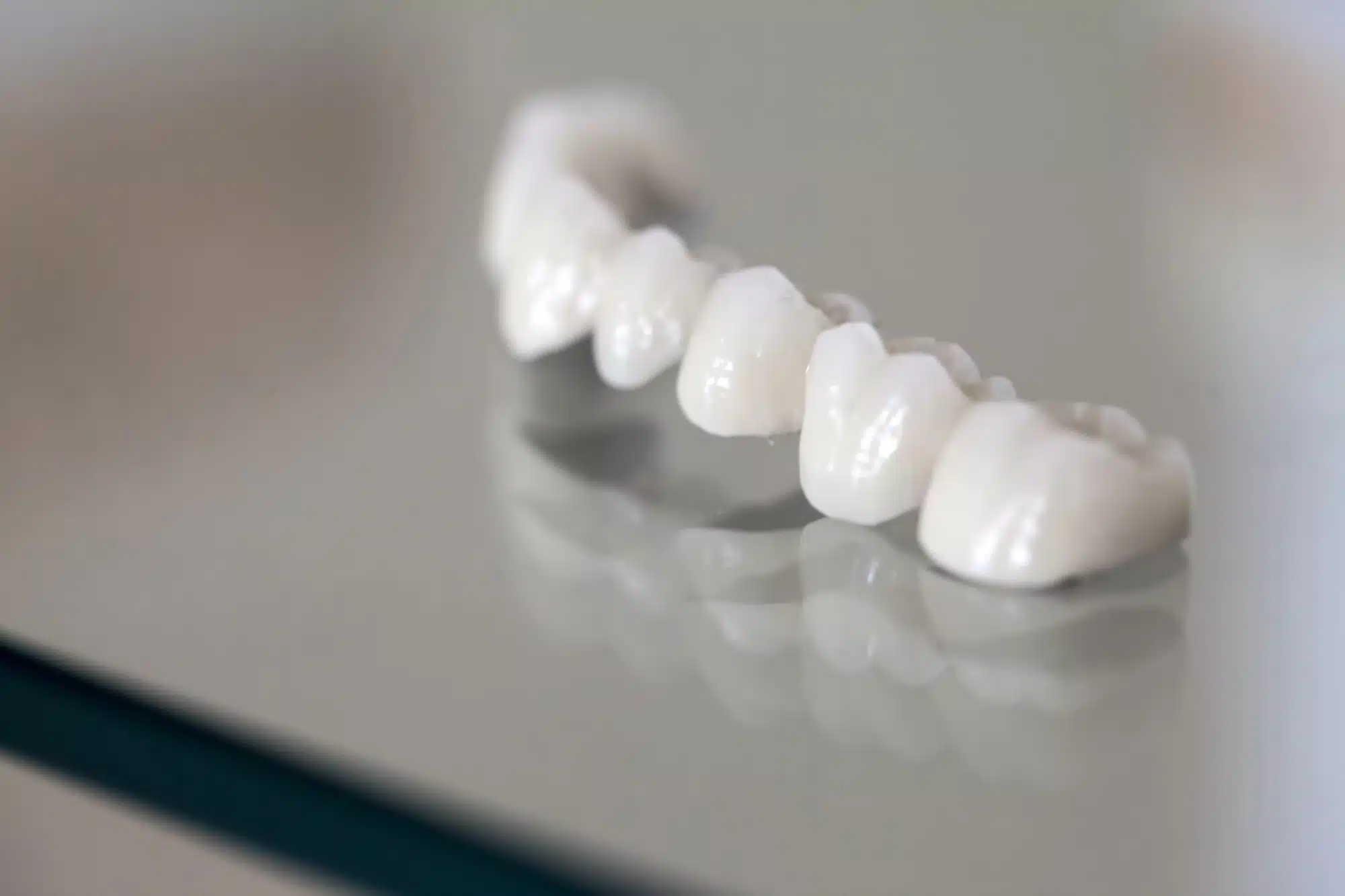 dental bridge in Grosse Pointe, MI