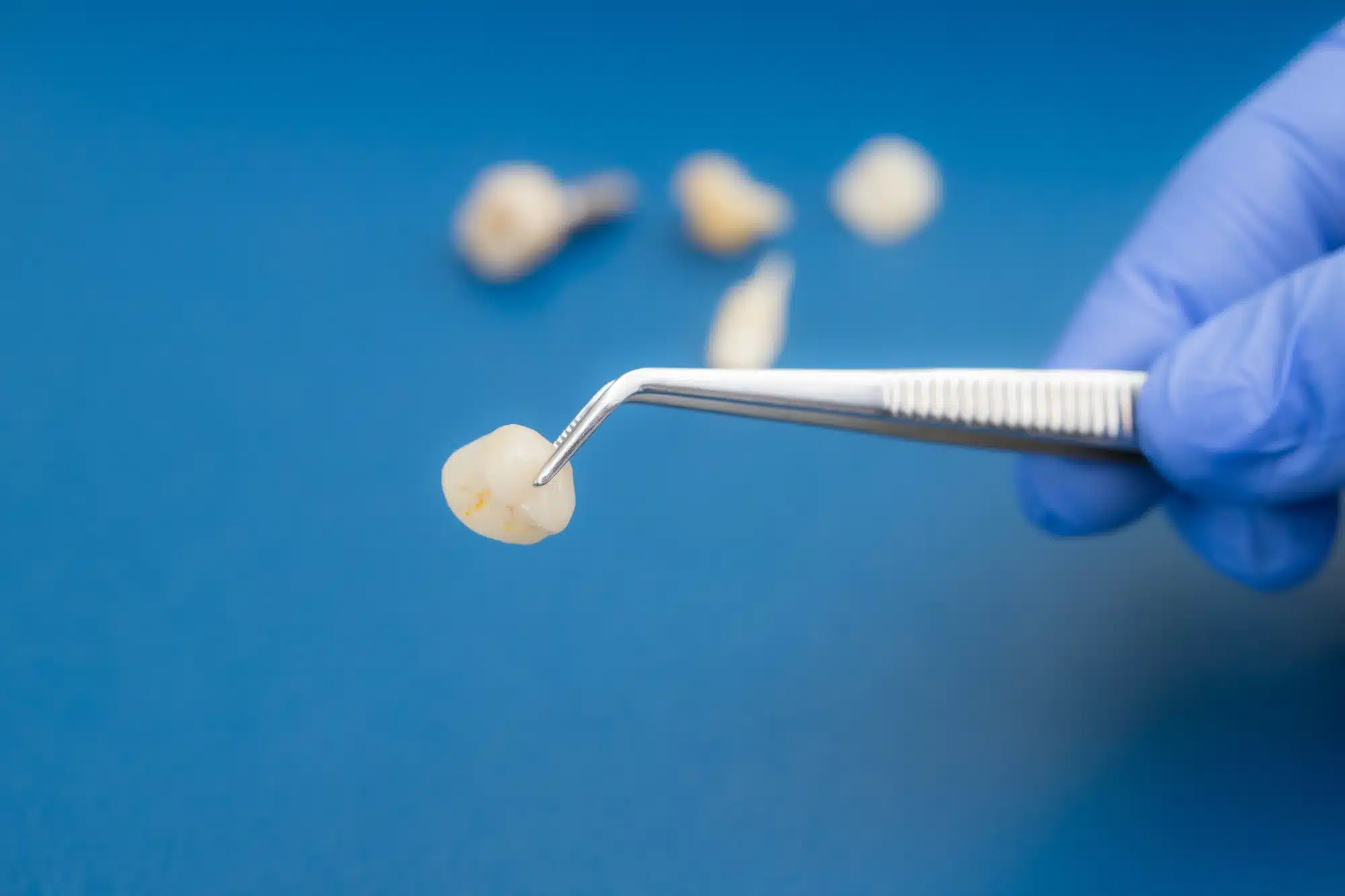 dental crowns in Grosse Pointe, MI